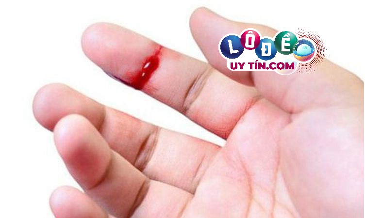 Mơ bị chặt ngón tay đánh con gì? Giải mã giấc mơ